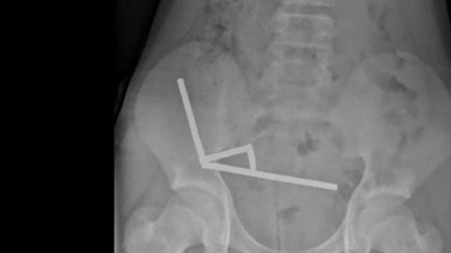 <ruby ><rb><span class="" word="1">1</span><span class="" word="3">3</span><span class="" word="さ">さ</span><span class="" word="い">い</span></rb><rt>じゅうさんさい</rt></ruby><span class="" word="の">の</span><ruby ><rb><span class="" word="男">男</span></rb><rt>おとこ</rt></ruby><span class="" word="の">の</span><ruby ><rb><span class="" word="子">子</span></rb><rt>こ</rt></ruby><span class="" word="、">、</span><span class="jlpt-n5" word="たくさん">たくさん</span><span class="" word="の">の</span><ruby ><rb><span class="" word="強">強</span></rb><rt>つよ</rt></ruby><span class="" word="い">い</span><span class="" word="じ">じ</span><span class="" word="し">し</span><span class="" word="ゃ">ゃ</span><span class="" word="く">く</span><span class="" word="を">を</span><span class="" word="の">の</span><span class="" word="み">み</span><span class="" word="こ">こ</span><span class="" word="ん">ん</span><span class="" word="で">で</span><ruby ><rb><span class="jlpt-n5" word="手">手</span></rb><rt>て</rt></ruby><span class="" word="じ">じ</span><span class="" word="ゅ">ゅ</span><span class="" word="つ">つ</span>