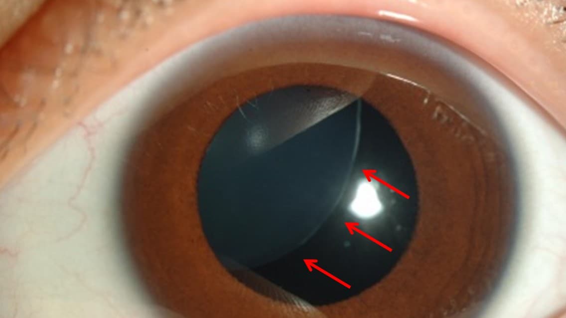 水晶体のしごと