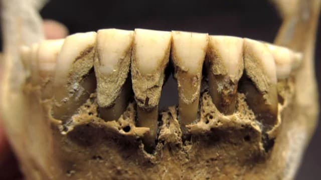 中世のウクライナ人の歯石からキビを食べたことが分かった