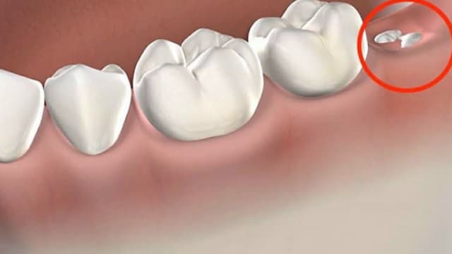 <ruby><rb><span class="unknown" word="大阪">大阪</span></rb><rt>おおさか</rt></ruby><span class="" word="の">の</span><ruby><rb><span class="jlpt-n5" word="病院">病院</span></rb><rt>びょういん</rt></ruby><span class="" word="、">、</span><span class="" word="A">A</span><span class="" word="I">I</span><span class="" word="で">で</span><ruby><rb><span class="unknown" word="親知らず">親知らず</span></rb><rt>おやしらず</rt></ruby><span class="" word="の">の</span><ruby><rb><span class="unknown" word="抜歯">抜歯</span></rb><rt>ばっし</rt></ruby><span class="" word="を">を</span><span class="" word="サ">サ</span><span class="" word="ポ">ポ</span><span class="" word="ー">ー</span><span class="" word="ト">ト</span>