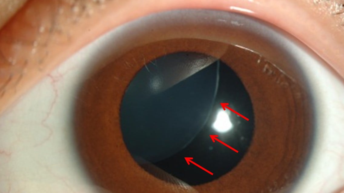 水晶体のしごと