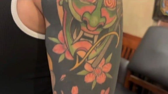 アメリカでタトゥーを消したい人が増えています